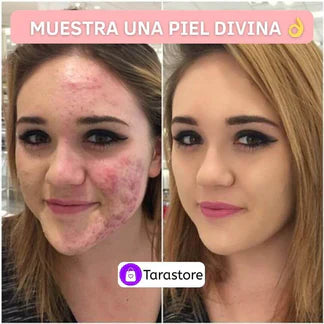 BASE CUSHION™- Base de alta cobertura